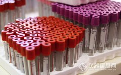 獨(dú)立醫(yī)學(xué)實(shí)驗(yàn)室：從216家增至356家，未來五年市場再添200億..